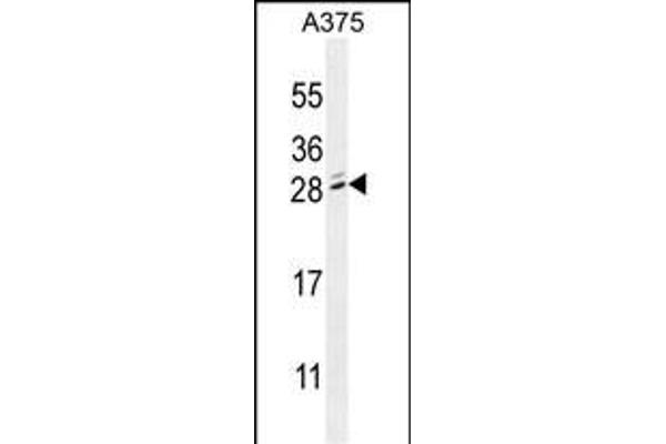 MBD3L2 Antikörper  (C-Term)