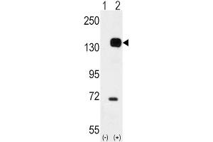 Western Blotting (WB) image for anti-TEK Tyrosine Kinase, Endothelial (TEK) antibody (ABIN3003424) (TEK antibody)