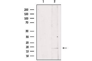 Western blot analysis of extracts from mouse brain, using ISG15 Antibody. (ISG15 antibody  (C-Term))