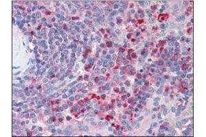 Immunohistochemistry (Paraffin-embedded Sections) (IHC (p)) image for anti-Chemokine (C-X-C Motif) Receptor 4 (CXCR4) (AA 14-40), (Extracellular Domain), (N-Term) antibody (ABIN614959)