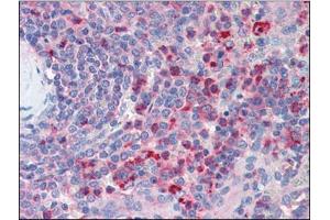 Human Spleen (formalin-fixed, paraffin-embedded) stained with CXCR4at 5 µg/ml followed by biotinylated anti-goat IgG secondary antibody, alkaline phosphatase-streptavidin and chromogen. (CXCR4 antibody  (Extracellular Domain, N-Term))