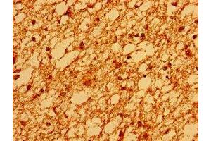 Immunohistochemistry of paraffin-embedded human brain tissue using ABIN7171099 at dilution of 1:100