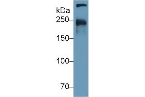 Detection of CUBN in Human Urine using Polyclonal Antibody to Cubilin (CUBN) (CUBN antibody  (AA 3157-3274))