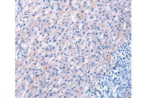 Immunohistochemistry (IHC) image for anti-Epidermal Growth Factor (EGF) antibody (ABIN6219771) (EGF antibody)