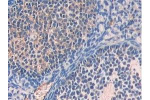 #VALUE! (Fetuin A antibody  (AA 19-250))