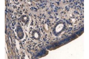 IHC-P analysis of Mouse Uterus Tissue, with DAB staining. (TMEM27 antibody  (Leu222))