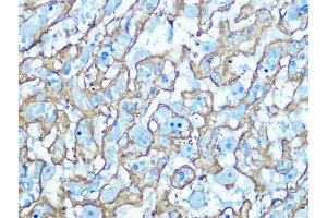 Immunohistochemistry of paraffin-embedded Rat placenta using GLUT1/SLC2 antibody (ABIN6129475, ABIN6147954, ABIN6147956 and ABIN6222743) at dilution of 1:100 (40x lens). (GLUT1 antibody  (AA 210-310))