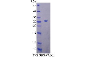 SDS-PAGE analysis of Human MTF1 Protein. (MTF1 Protein)