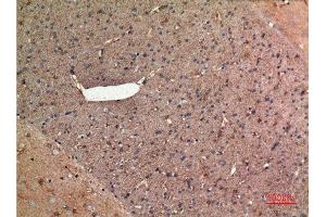 Immunohistochemistry (IHC) image for anti-Aldolase C, Fructose-Bisphosphate (ALDOC) (N-Term) antibody (ABIN3187723)
