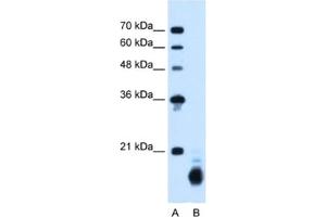 Western Blotting (WB) image for anti-Cyclophilin B (PPIB) antibody (ABIN2462813) (PPIB antibody)