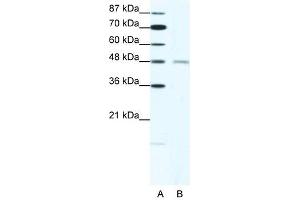 CHRND antibody (20R-1325) used at 1. (CHRND antibody  (N-Term))