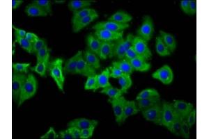 Immunofluorescence staining of HepG2 cells with ABIN7163104 at 1:133, counter-stained with DAPI. (PHEX antibody  (AA 524-673))
