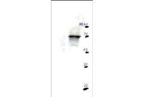 Western blot using Rockland's Affinity Purified anti-p70S6K antibody shows detection of a predominant band corresponding to p70S6K in mouse brain extract (right lane) after immunoprecipitation. (RPS6KB1 antibody  (C-Term))
