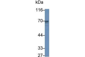 Detection of CD73 in Human Placenta lysate using Polyclonal Antibody to Cluster Of Differentiation 73 (CD73) (CD73 antibody  (AA 29-500))