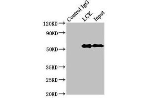 Immunoprecipitating LCK in Jurkat whole cell lysate Lane 1: Rabbit control IgG (1 μg) instead of ABIN7174038 in Jurkat whole cell lysate. (LCK antibody  (AA 1-539))