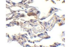 Immunohistochemistry of cIAP in human lung cells with cIAP antibody at 10 μg/ml. (BIRC2 antibody  (C-Term))