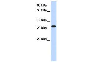 SIP1 antibody used at 1 ug/ml to detect target protein.