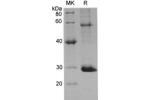 AKT1 Protein (His tag)