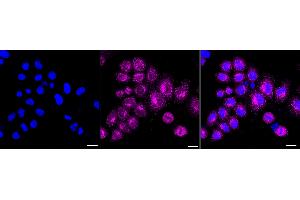 anti-Cytochrome P450, Family 19, Subfamily A, Polypeptide 1 (CYP19A1) antibody