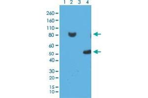 Western blot analysis of 293T cell Lane 1: untransfected with His-Tag fusion protein X, Lane 2: transfected with His-Tag fusion protein X, Lane 3: E. (His Tag antibody  (N-Term))