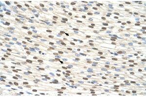 Human Heart; ZNF274 antibody - N-terminal region in Human Heart cells using Immunohistochemistry (ZNF274 antibody  (N-Term))