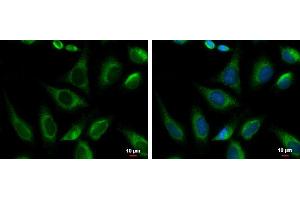 ICC/IF Image PRKCSH antibody [N1C1] detects PRKCSH protein at endoplasmic reticulum by immunofluorescent analysis.