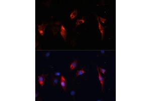 Immunofluorescence analysis of C6 cells using Cathepsin L/V/K/H antibody (ABIN6127670, ABIN6139235, ABIN6139237 and ABIN6215636) at dilution of 1:100. (Cathepsin L antibody  (AA 114-333))