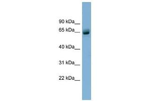 SLFN12 antibody used at 1 ug/ml to detect target protein. (SLFN12 antibody  (N-Term))