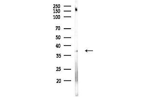 anti-Olfactory Receptor, Family 3, Subfamily A, Member 1 (OR3A1) antibody