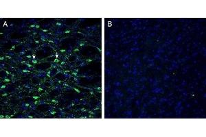 Expression of Histamine H1 Receptor in mouse substantia nigra - Immunohistochemical staining of perfusion-fixed frozen mouse brain sections with Anti-Histamine H1 Receptor/HRH1 Antibody (extracellular) (ABIN7043269, ABIN7044512 and ABIN7044513), (1:300), followed by goat anti-rabbit-AlexaFluor-488. (HRH1 antibody  (2nd Extracellular Loop))