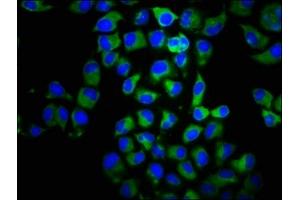 Immunofluorescence staining of Hela cells with ABIN7145922 at 1:100, counter-stained with DAPI. (CCR2 antibody  (AA 310-374))