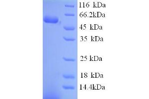 SDS-PAGE (SDS) image for Vimentin (VIM) (AA 2-466) protein (His tag) (ABIN7478956)