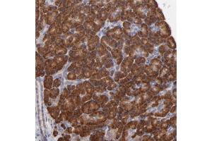 Immunohistochemical staining of human pancreas with RPL9 polyclonal antibody  shows strong cytoplasmic positivity in exocrine glandular cells.