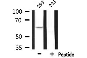 Western blot analysis of extracts from 293, using CERKL Antibody. (CERKL antibody  (Internal Region))