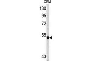 Western blot analysis of MYCN antibody (C-term) in CEM cell line lysates (35ug/lane). (MYCN antibody  (C-Term))