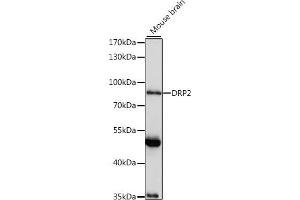 Western blot analysis of extracts of mouse brain, using DRP2 antibody (ABIN7266872) at 1:1000 dilution. (DRP2 antibody  (AA 1-240))