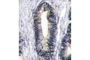 Immunohistochemistry (Paraffin-embedded Sections) (IHC (p)) image for anti-EPH Receptor B2 (EPHB2) (AA 1021-1050), (C-Term) antibody (ABIN391920)