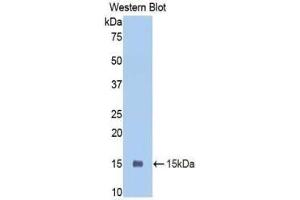 Western blot analysis of the recombinant protein. (PIGR antibody  (AA 352-457))