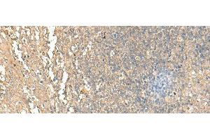 Immunohistochemistry of paraffin-embedded Human tonsil tissue using NARS Polyclonal Antibody at dilution of 1:55(x200) (NARS antibody)