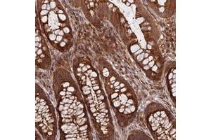 Immunohistochemical staining of human rectum with INO80D polyclonal antibody  shows strong cytoplasmic positivity in glandular cells. (IN80D antibody)