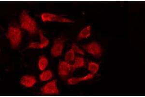 ABIN6267008 staining COS7 by IF/ICC. (KRT15 antibody)