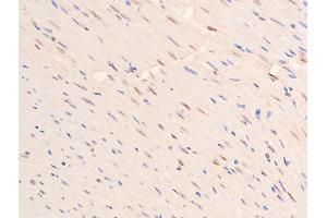 Immunohistochemistry (IHC) image for anti-Tumor Protein P53 (TP53) (pSer392) antibody (ABIN6256312)