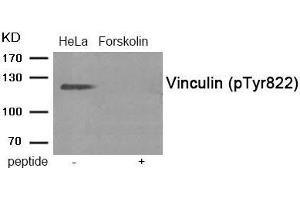 Western blot analysis of extracts from HeLa cells treated with Forskolin using Phospho-Vinculin (Tyr822) antibody. (Vinculin antibody  (pTyr822))