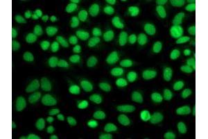 Immunofluorescent staining of HeLa cells using anti-FGFR2 mouse monoclonal antibody (ABIN2454529).