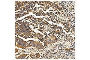 IHC analysis of PDE6 beta/PDE6B using anti-PDE6 beta/PDE6B antibody (ABIN7600894). (PDE6B antibody  (AA 25-237))
