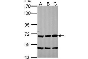 WB Image Sample (30 ug of whole cell lysate) A: NT2D1 B: IMR32 C: U87-MG 7. (SCG2 antibody)