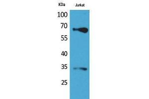 Western Blotting (WB) image for anti-Nuclear Factor (erythroid-Derived 2)-Like 2 (NFE2L2) (Thr142) antibody (ABIN3187850) (NRF2 antibody  (Thr142))