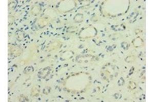 Immunohistochemistry of paraffin-embedded human kidney tissue using ABIN7153466 at dilution of 1:100 (Galectin 9 antibody  (AA 1-240))