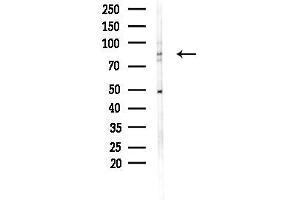 anti-rho GTPase Activating Protein 9 (ARHGAP9) (Internal Region) antibody