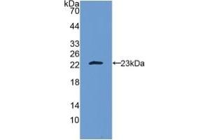 Detection of Recombinant IL10, Human using Polyclonal Antibody to Interleukin 10 (IL10) (IL-10 antibody  (AA 19-178))